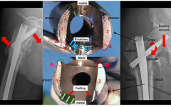 Photo of how implants and components are tested for failure.