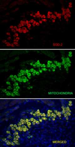 auditory spiral ganglia