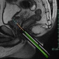 Corresponding sagittal T2-weighted image