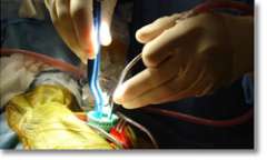 minimally-invasive microcraniotomy