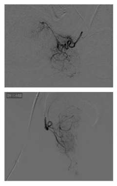 PAE Figure 2