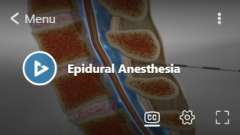 Anesthesia for Labor and Delivery