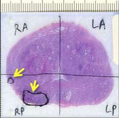 Whole-mount pathology