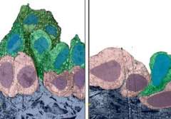 scientists identify links in lung cancer