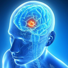 Epilepsy figure