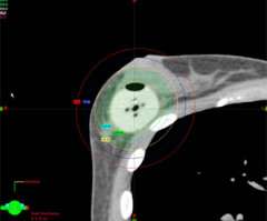 CT Scan