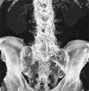 dual energy original