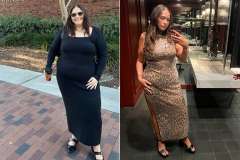Simonne before and after Gastric Sleeve surgery at UCLA Health