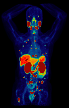 Theranostics imaging