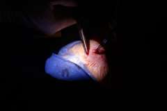 Thoracic Surgery