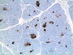 Pancreas of a healthy child.