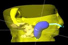 3d image