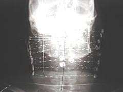 radiograph