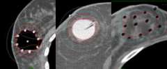 breast image