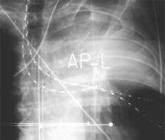 radiograph