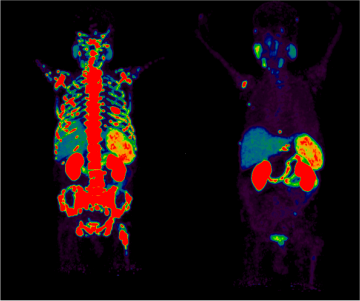 Dual thermal imaging of a human body, highlighting skeletal and organ structures.