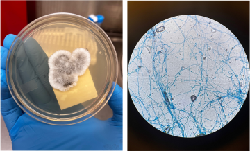 Gloved hand holds a petri dish with mold growth, alongside a microscope view of blue-stained fungal hyphae. 