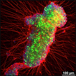 detailed medical illustration of crispr core