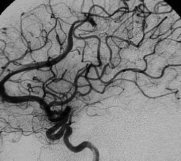 Figure 6 - After Treatment