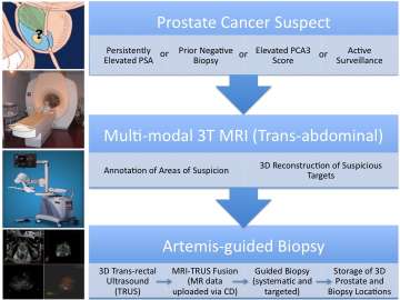 Artemis-guided TRUS biopsy