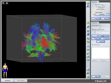 brain fibers close up