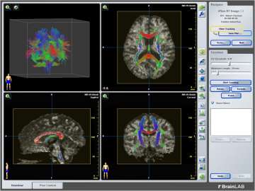 brain fibers