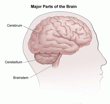 effects of stroke
