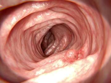 Intestine