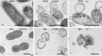 Ultrastructural evidence of killing of OM pathogens