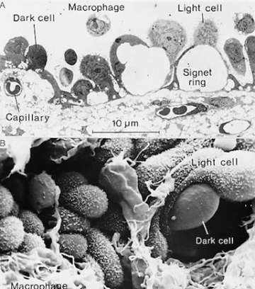 Ultrastructure of endolymphatic sac epithelial cells (chinchilla).