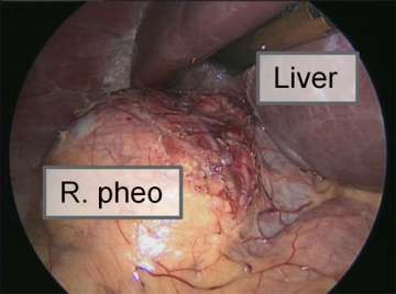 R. pheo, Liver