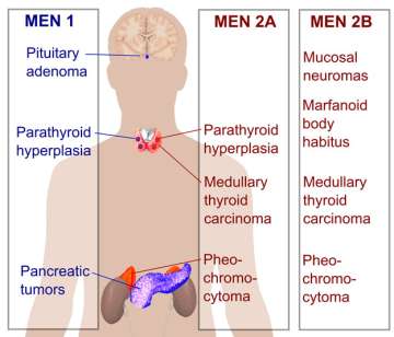 MEN 1, MEN 2A, MEN 2B