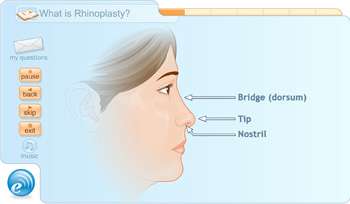 rhinoplasty