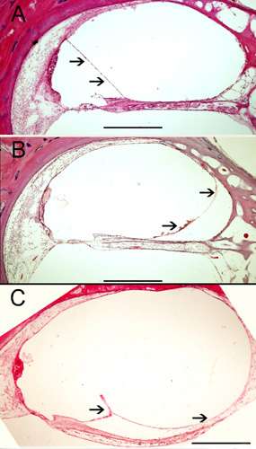 Neurotology human temporal