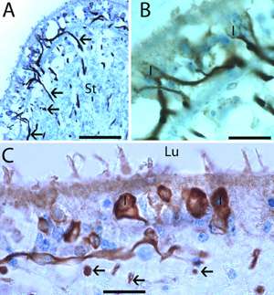 Neurotology human vestibule