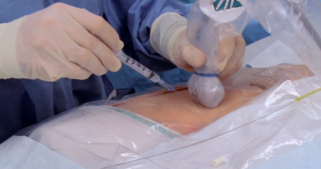 Procedure Service