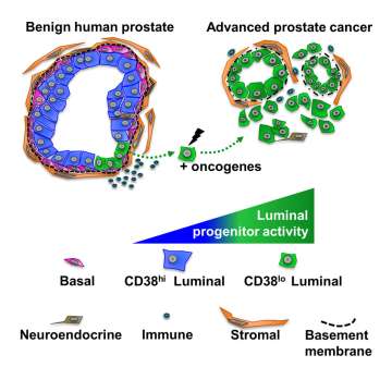 Prostate Cancer