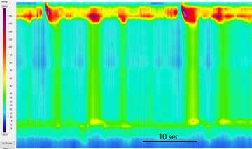 Manometry reading