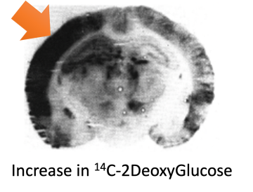 BIRC Image