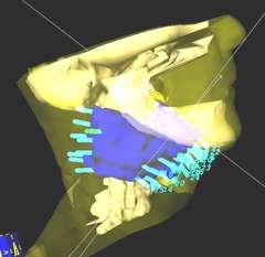 3-D image
