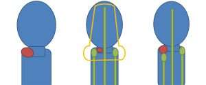 beam radiation