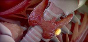 Parathyroid