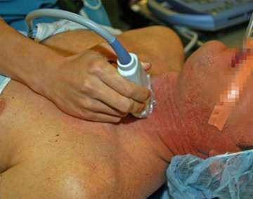 Pre-op Ultrasound