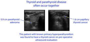 Thyroid and Parathyroid Disease