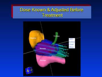 dose chart