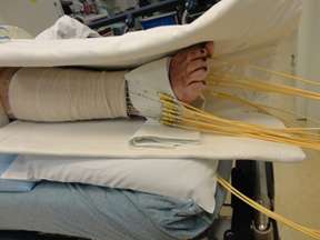 carcinoma cancer on leg