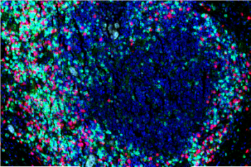 Translational Pathology Core Laboratory slide showing a lot of blue, green and pink dots.