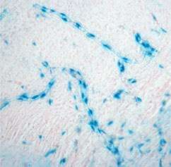 CCN2 expression in endothelial cells