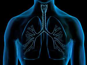 X-ray of lungs