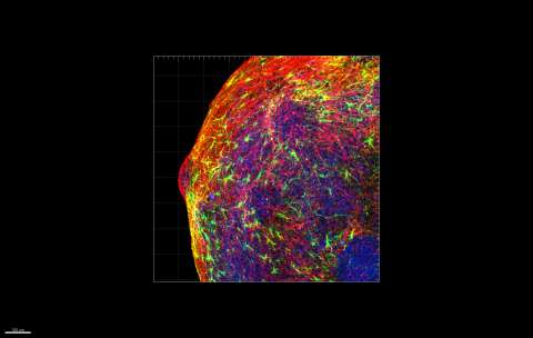 Organoid model